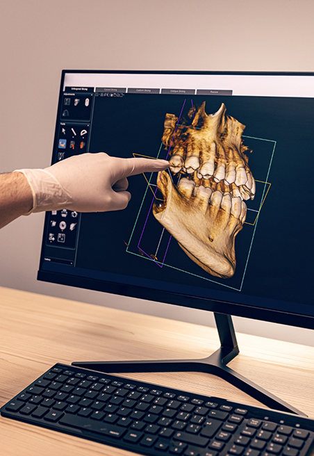Pointing to an image of teeth on a computer screen