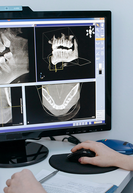 Multiple dental X rays on a computer monitor